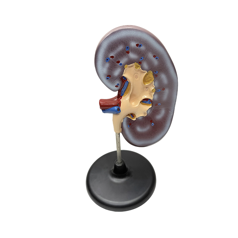 Vzdelávací anatomický model ľudskej obličky