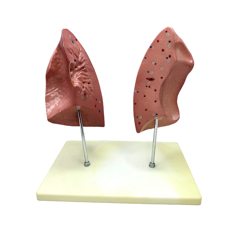 Učebný biologický model ľavé a pravé pľúca model ľudského útrob pľúcny anatomický model